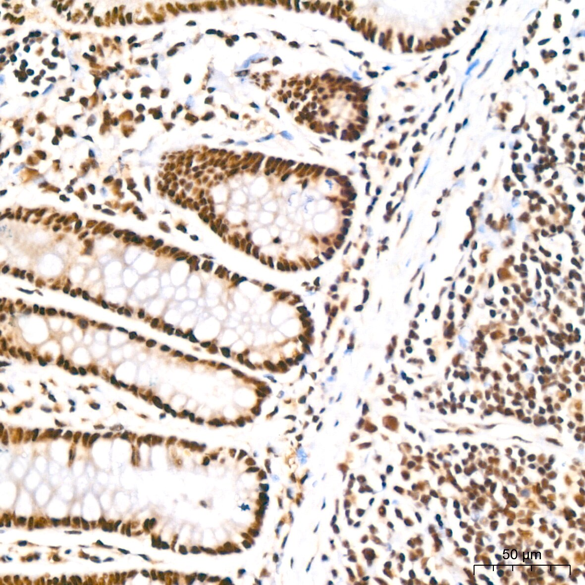 PABPN1 Antibody (7V4X8)