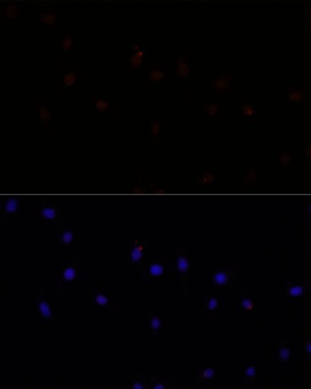 Calpain 7 Antibody - Azide and BSA Free