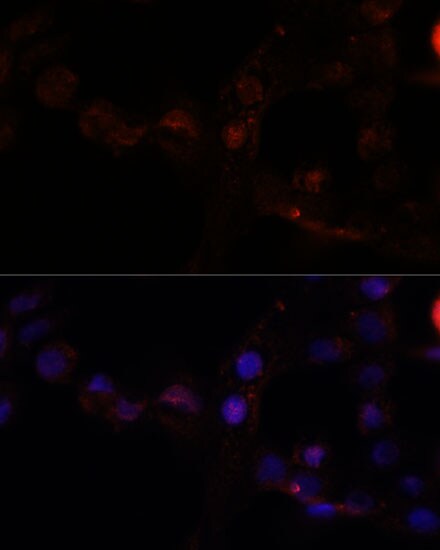 Calpain 7 Antibody - Azide and BSA Free