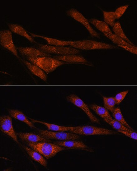 ARHGAP30 Antibody - Azide and BSA Free