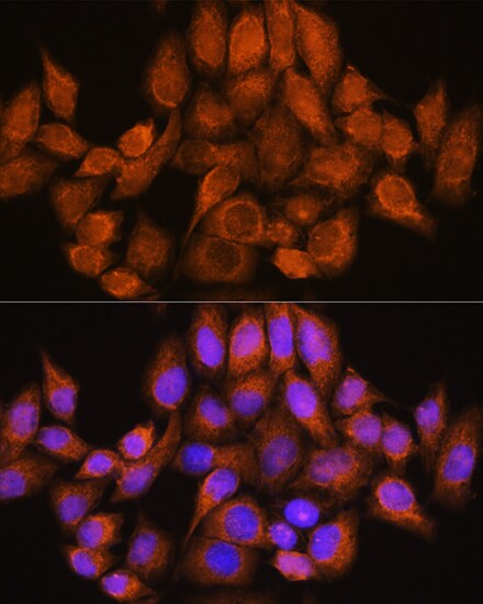 ARHGAP30 Antibody - Azide and BSA Free