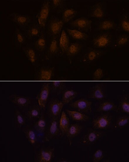 MED15 Antibody - Azide and BSA Free