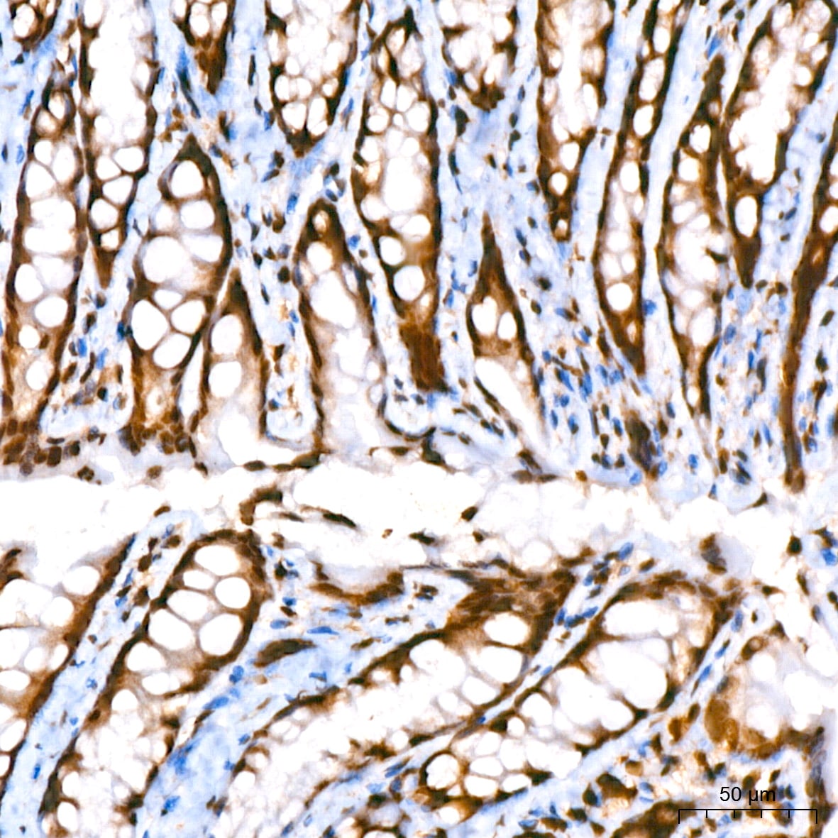 HIST1H2AB Antibody (1P5B6)