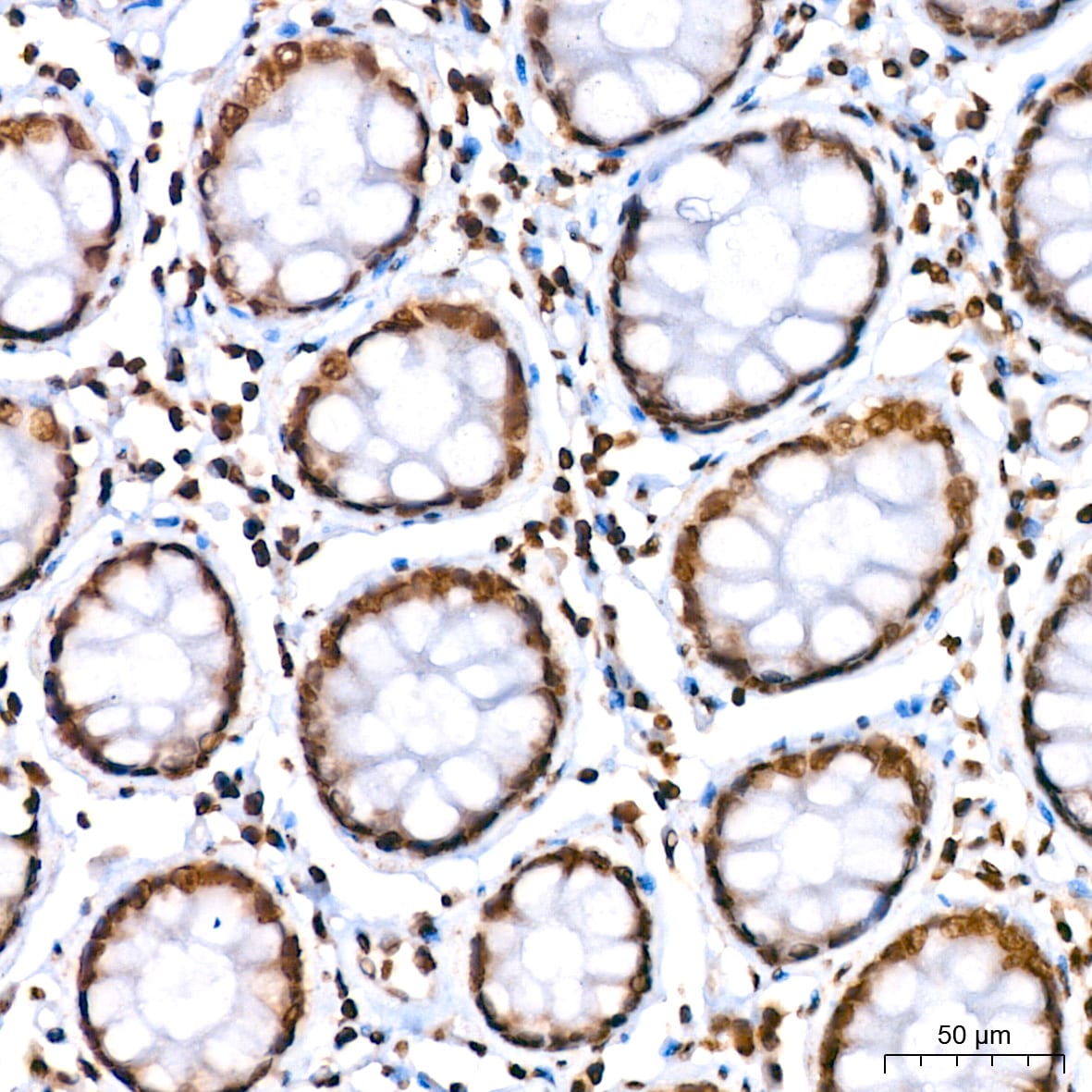 HIST1H2AB Antibody (1P5B6)