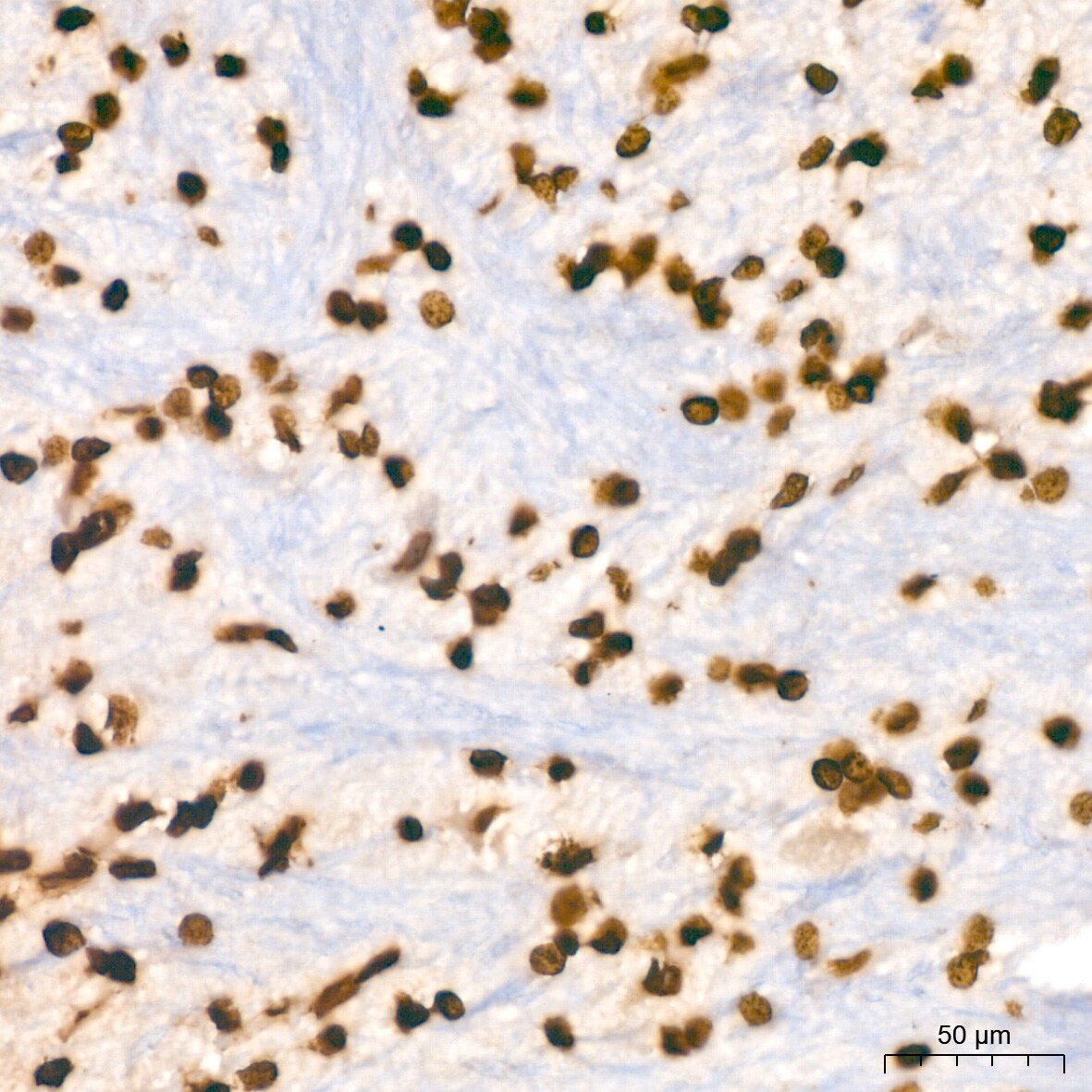 Histone H2B Antibody (3U2P5)