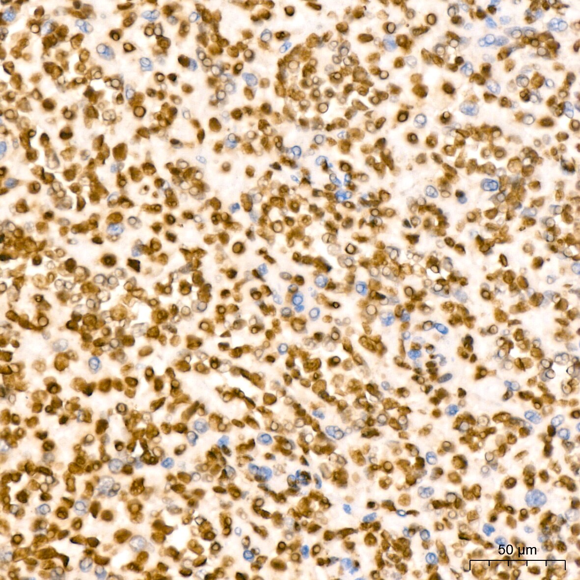Histone H2B Antibody (3U2P5)
