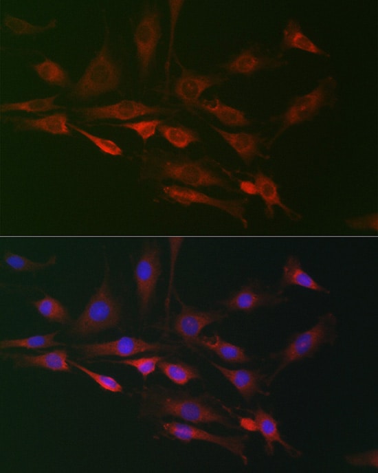 RAI16 Antibody - Azide and BSA Free