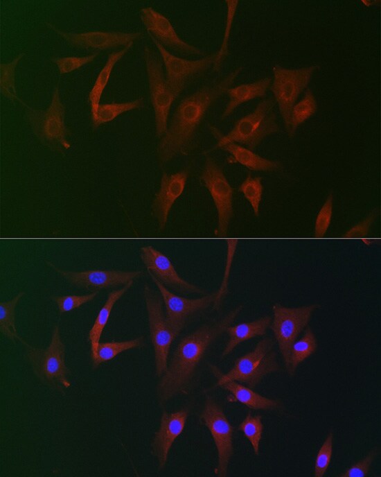 RAI16 Antibody - Azide and BSA Free