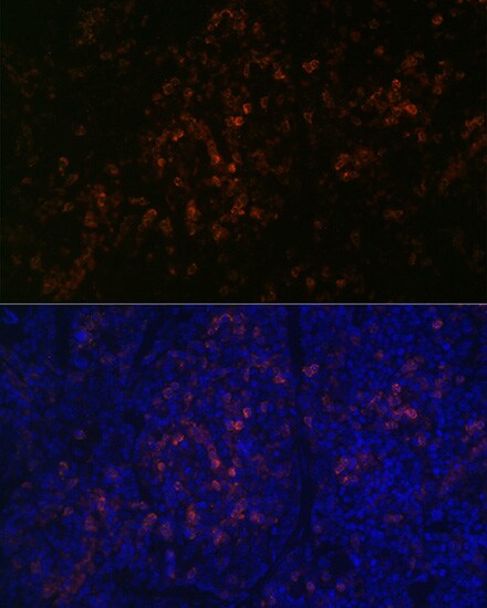 BTK Antibody (2J9O8)