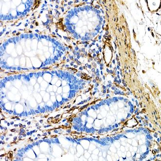 Caveolin-1 Antibody (10Y5L2)
