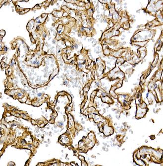 Caveolin-1 Antibody (10Y5L2)
