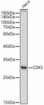 Cdk5 Antibody (7C8T10)