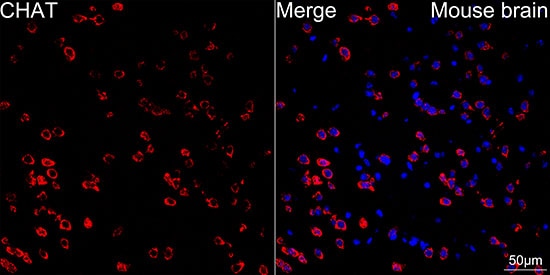 Choline Acetyltransferase/ChAT Antibody (1I4V0)