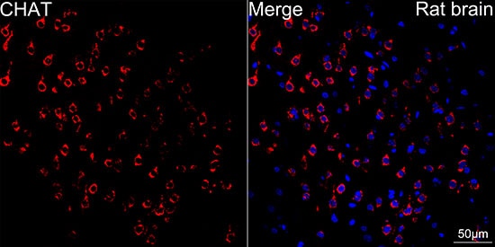 Choline Acetyltransferase/ChAT Antibody (1I4V0)