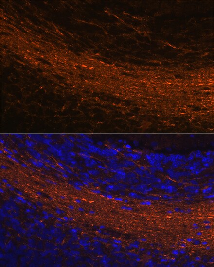 CNPase Antibody (8O3B6)