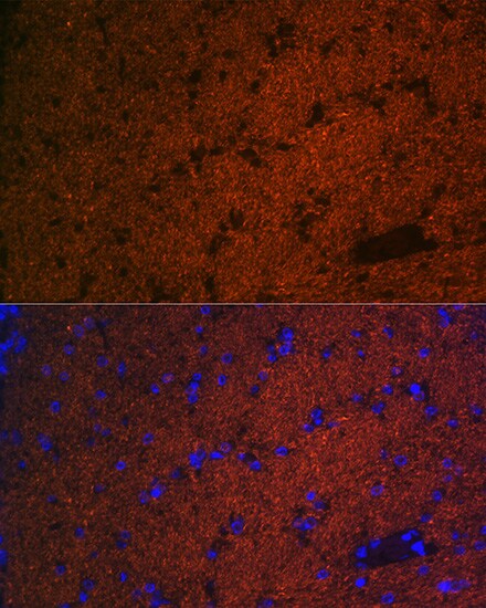 CNPase Antibody (8O3B6)