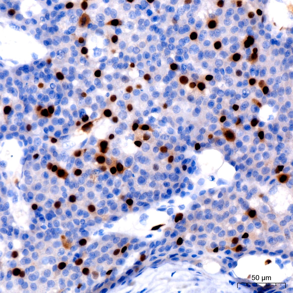 Cyclin A2 Antibody (3E9Z3)