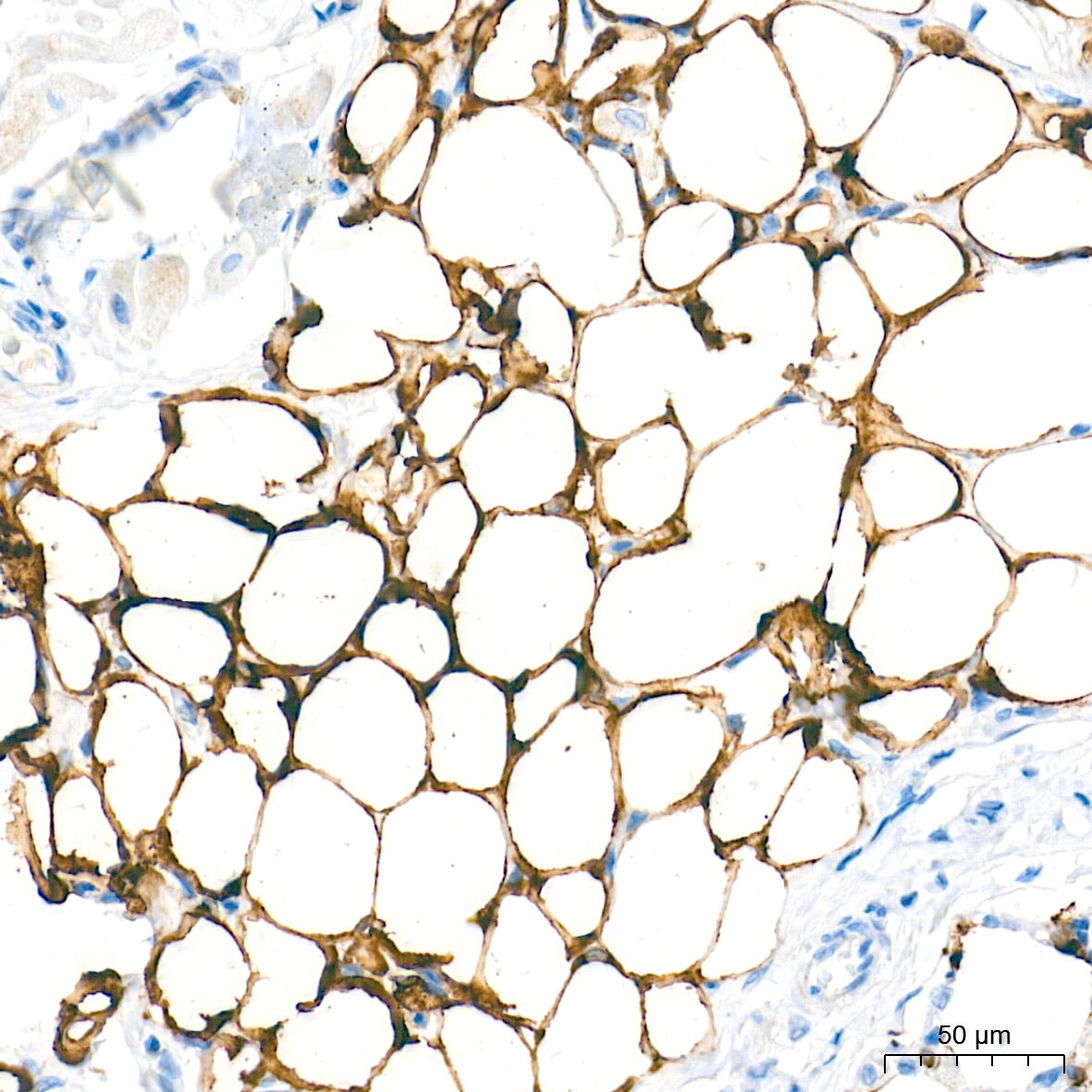 Fatty Acid Synthase/FASN Antibody (4U9S3)