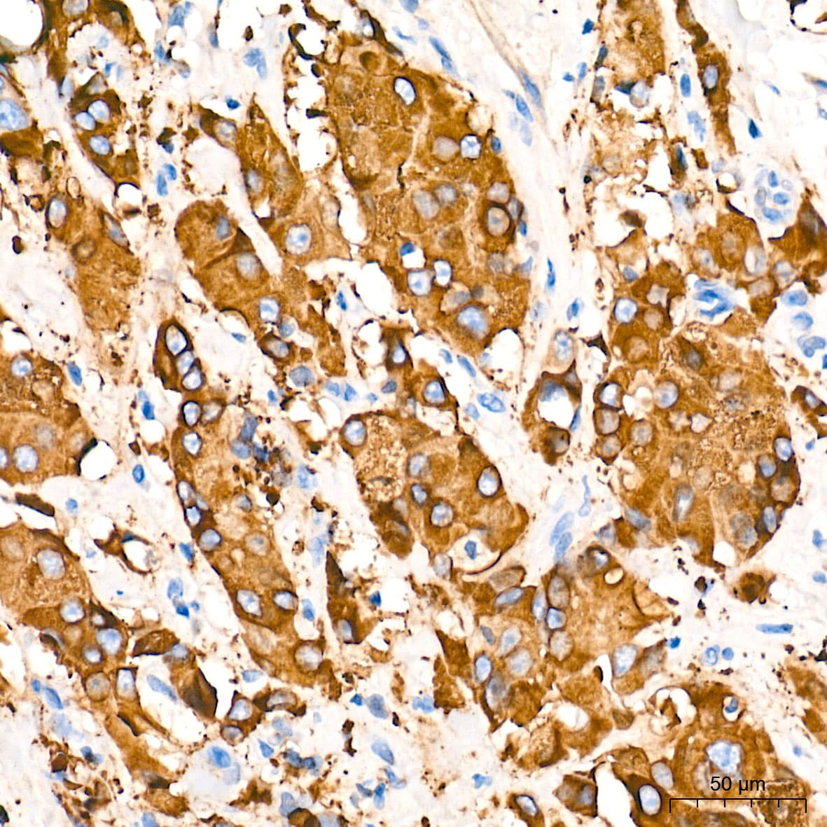Fatty Acid Synthase/FASN Antibody (4U9S3)