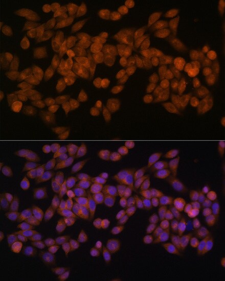 Fatty Acid Synthase/FASN Antibody (4U9S3)