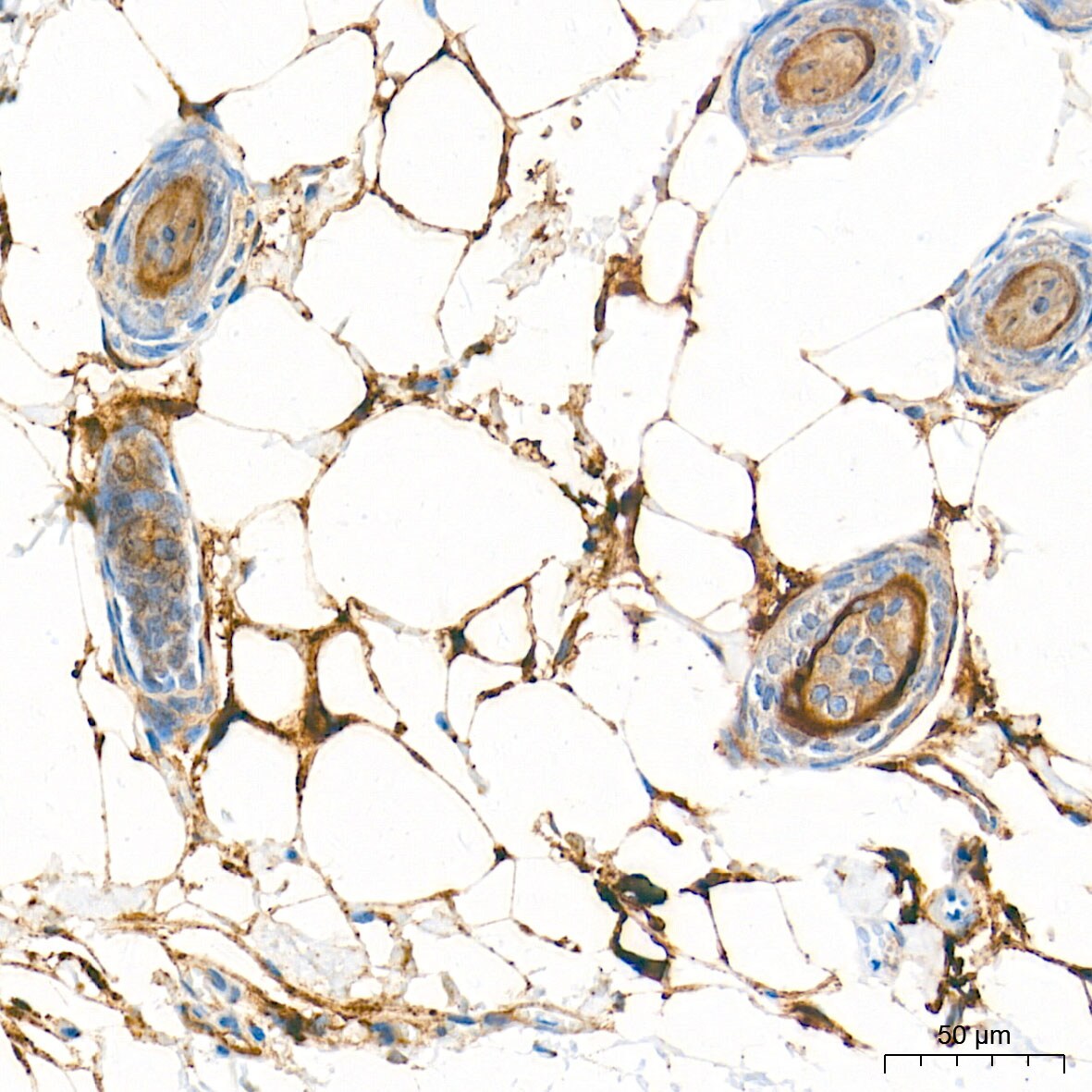 Fatty Acid Synthase/FASN Antibody (4U9S3)