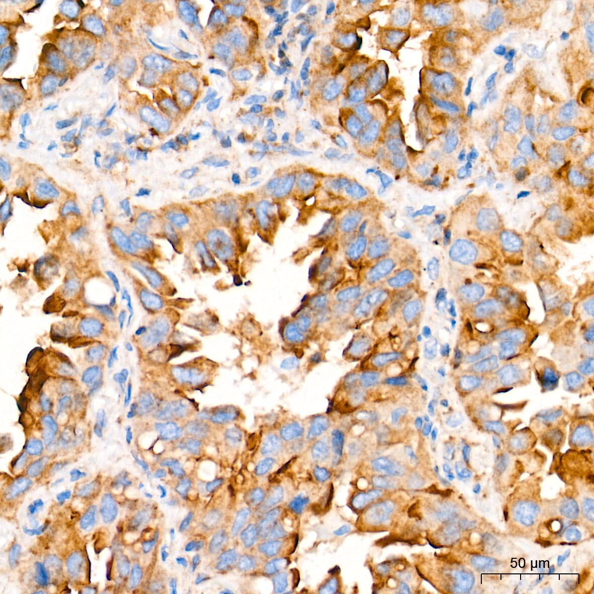 Fatty Acid Synthase/FASN Antibody (4U9S3)