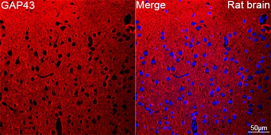 GAP-43 Antibody (8E7C8)