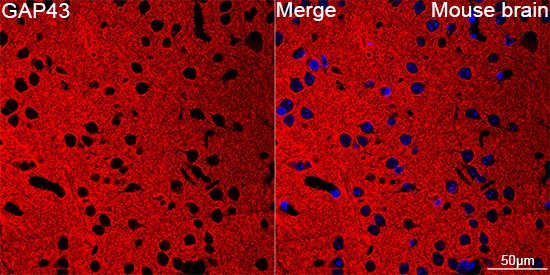 GAP-43 Antibody (8E7C8)
