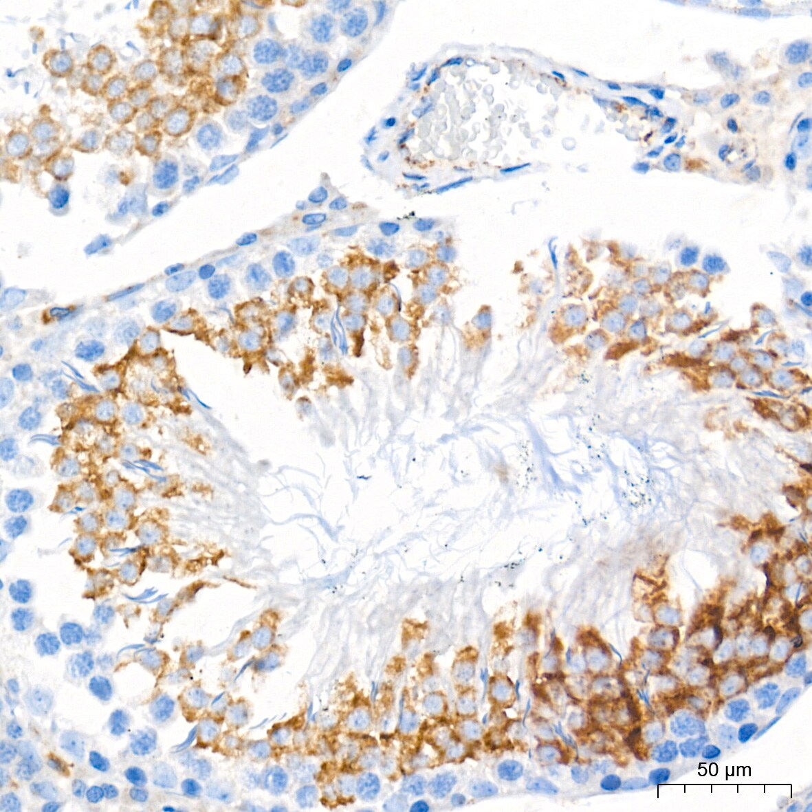 Glucosylceramidase/GBA Antibody (8O3Z7)