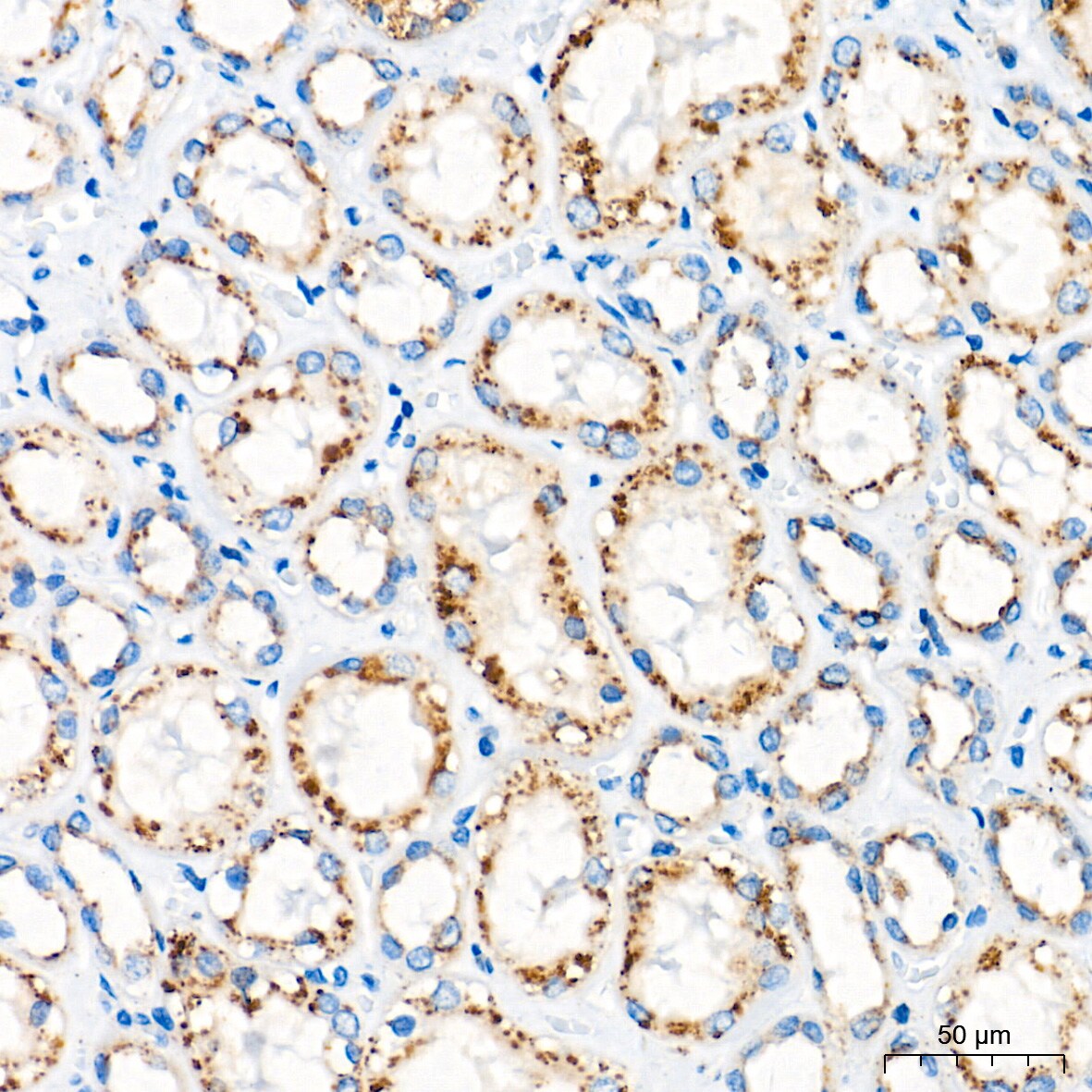 Glucosylceramidase/GBA Antibody (8O3Z7)