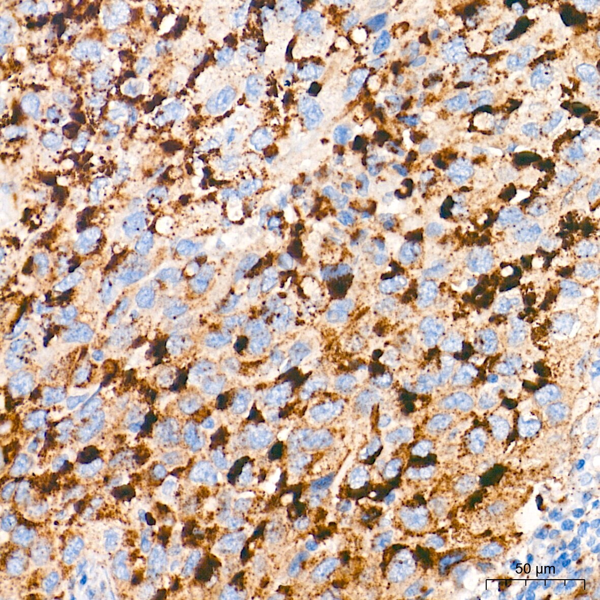 Glucosylceramidase/GBA Antibody (8O3Z7)
