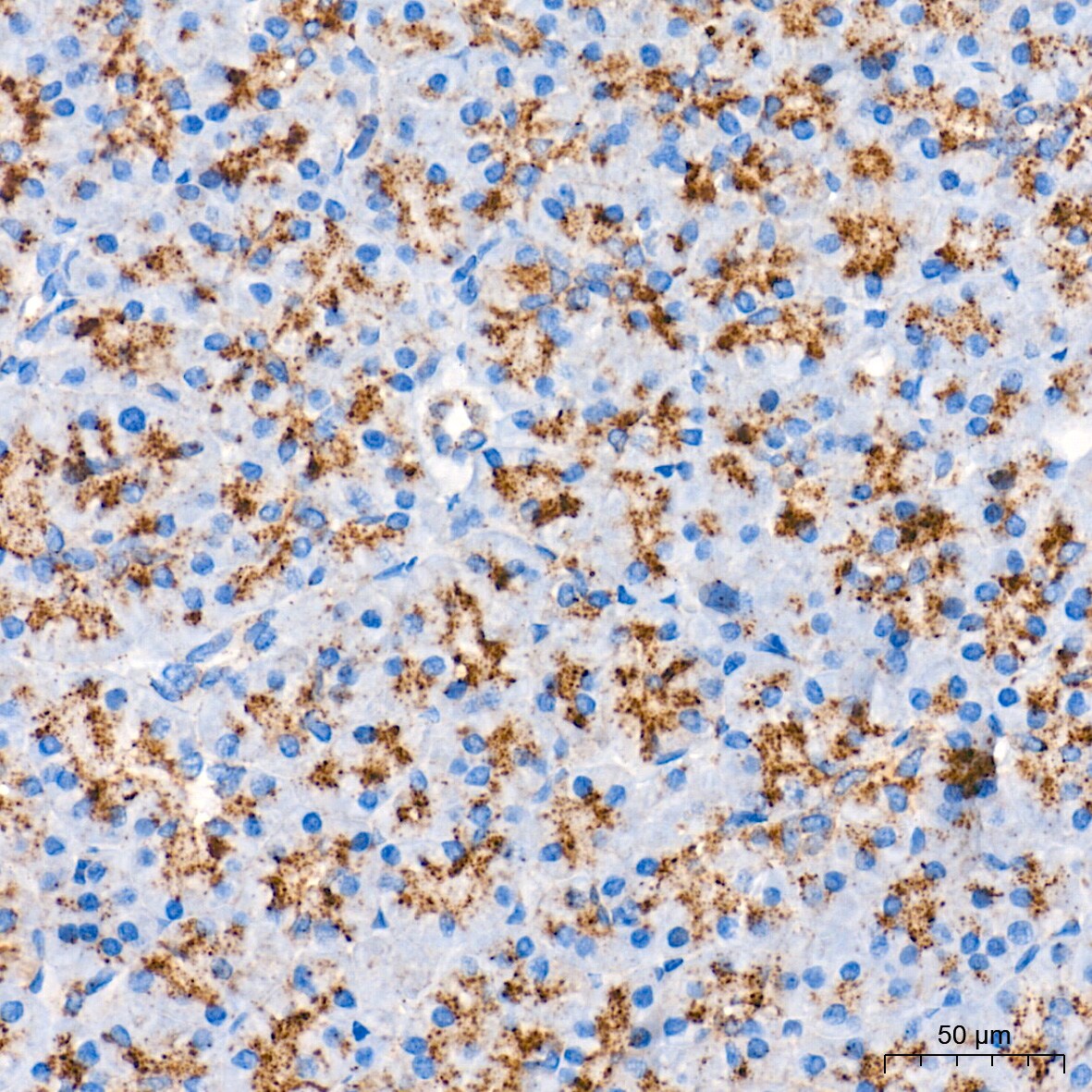 Glucosylceramidase/GBA Antibody (8O3Z7)