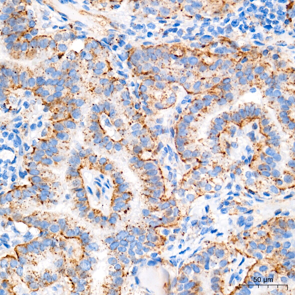 Glucosylceramidase/GBA Antibody (8O3Z7)