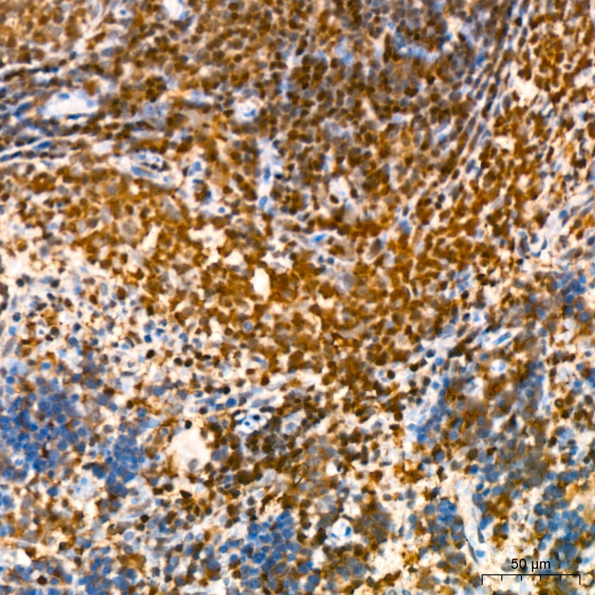 GRB2 Antibody (9K6H0)
