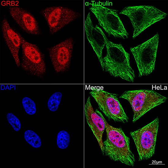 GRB2 Antibody (9K6H0)