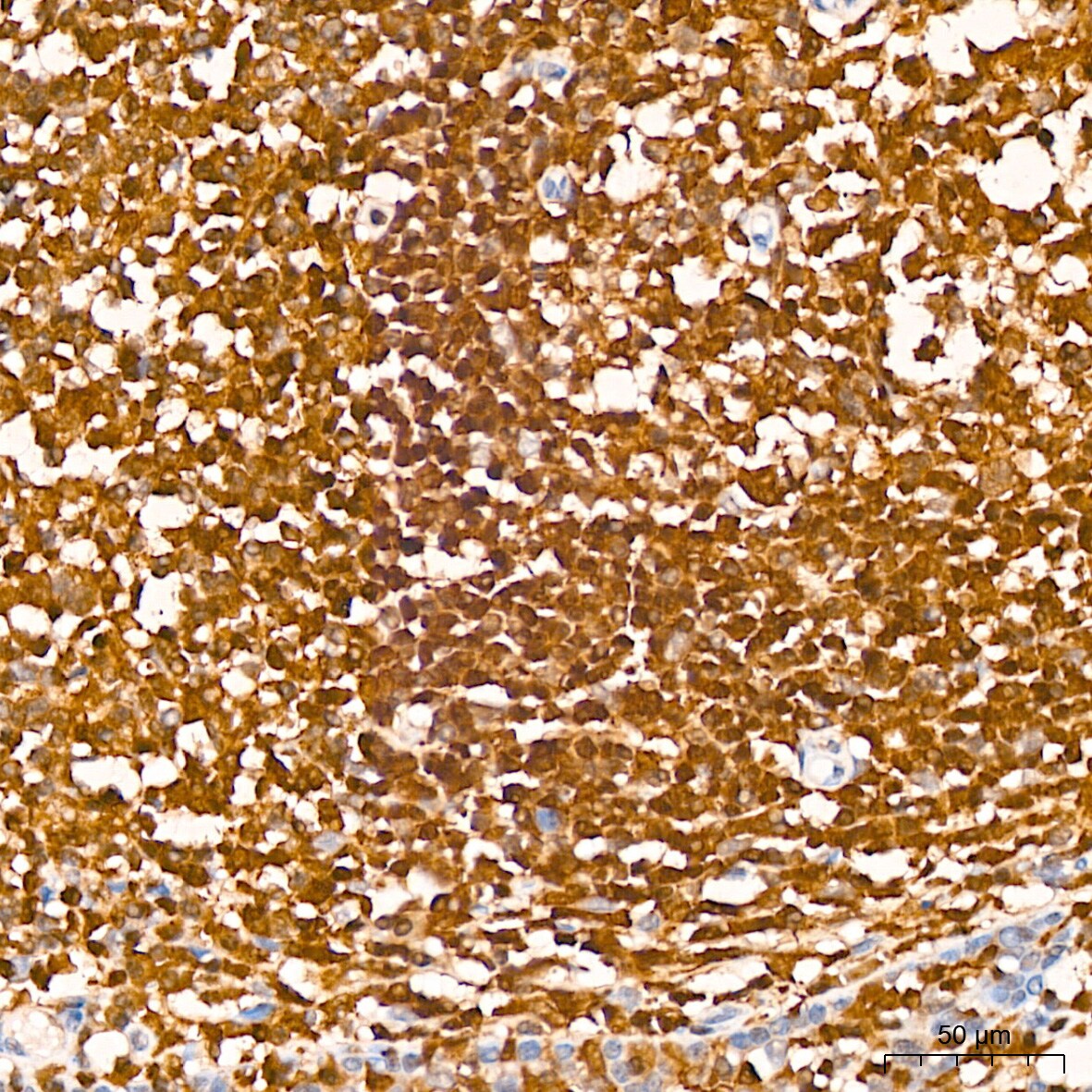 GRB2 Antibody (9K6H0)