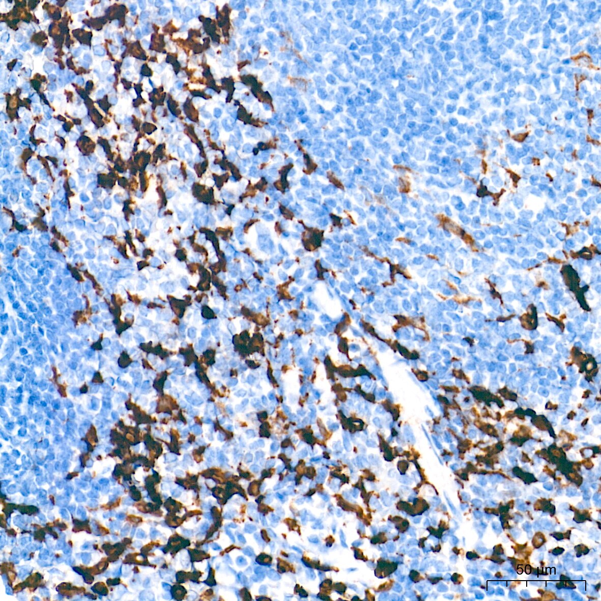 HO-1/HMOX1/HSP32 Antibody (7H7W10)