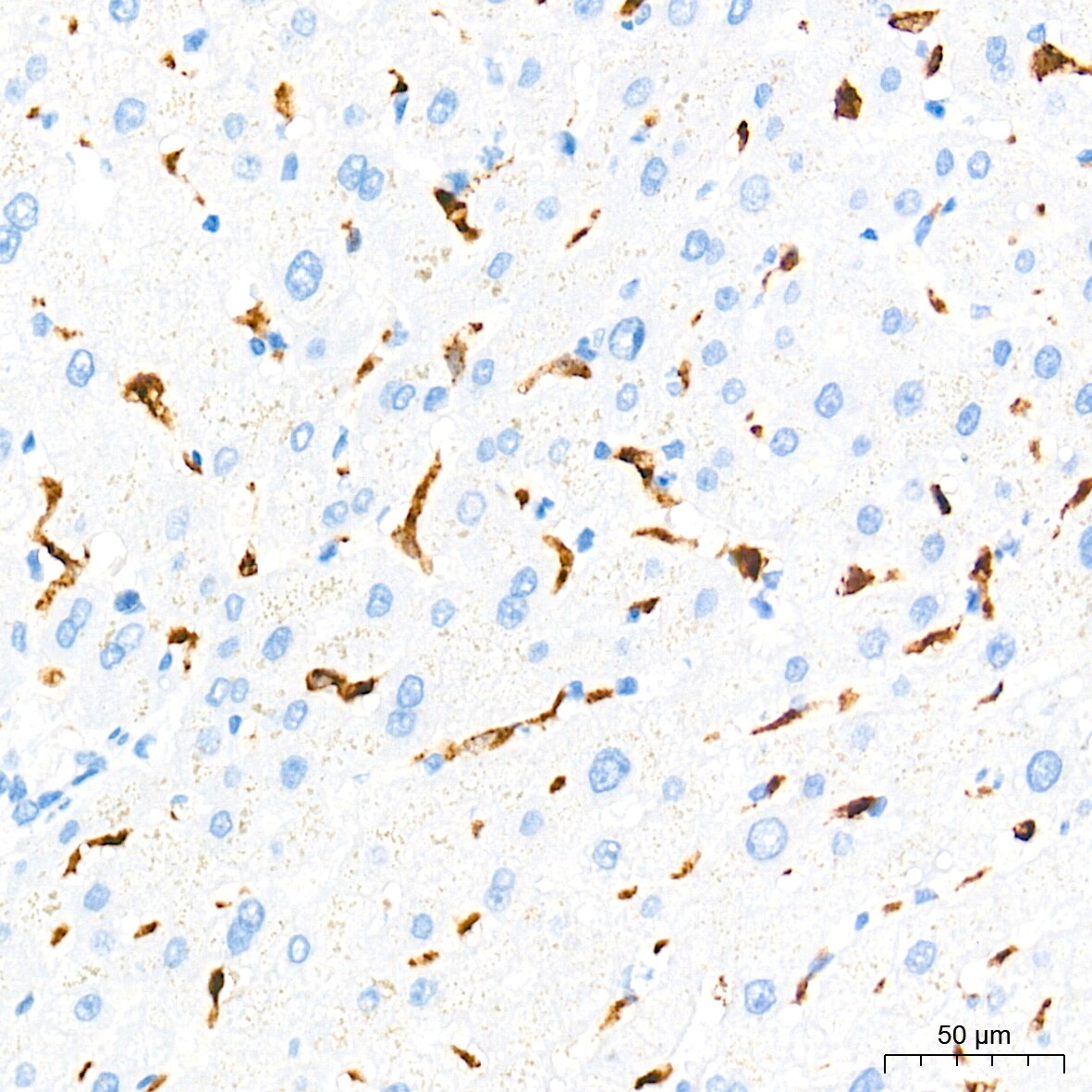 HO-1/HMOX1/HSP32 Antibody (7H7W10)