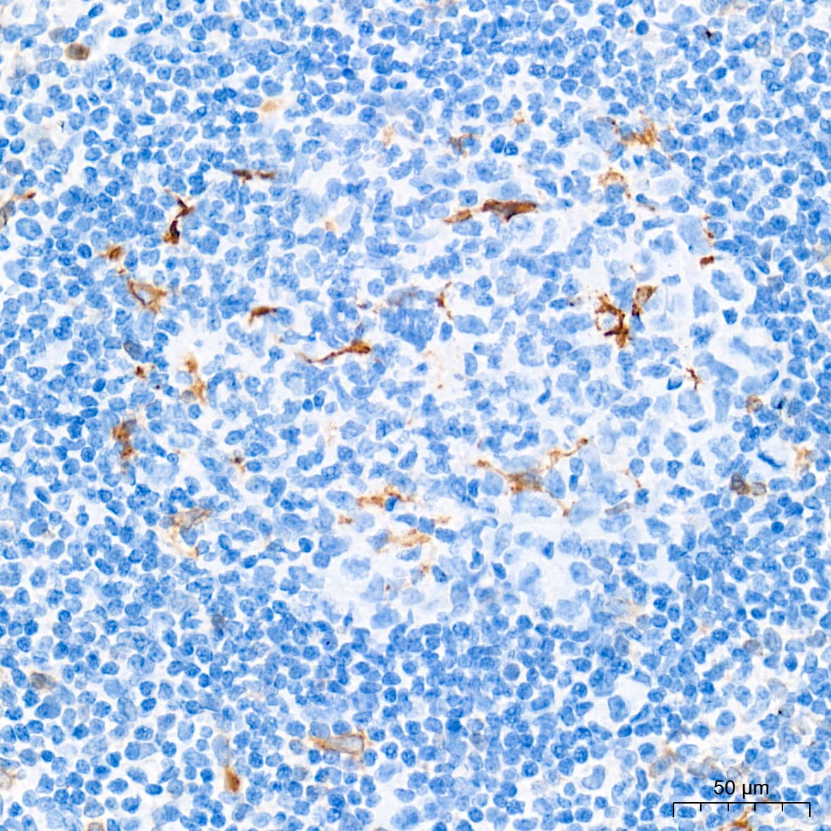 HO-1/HMOX1/HSP32 Antibody (7H7W10)