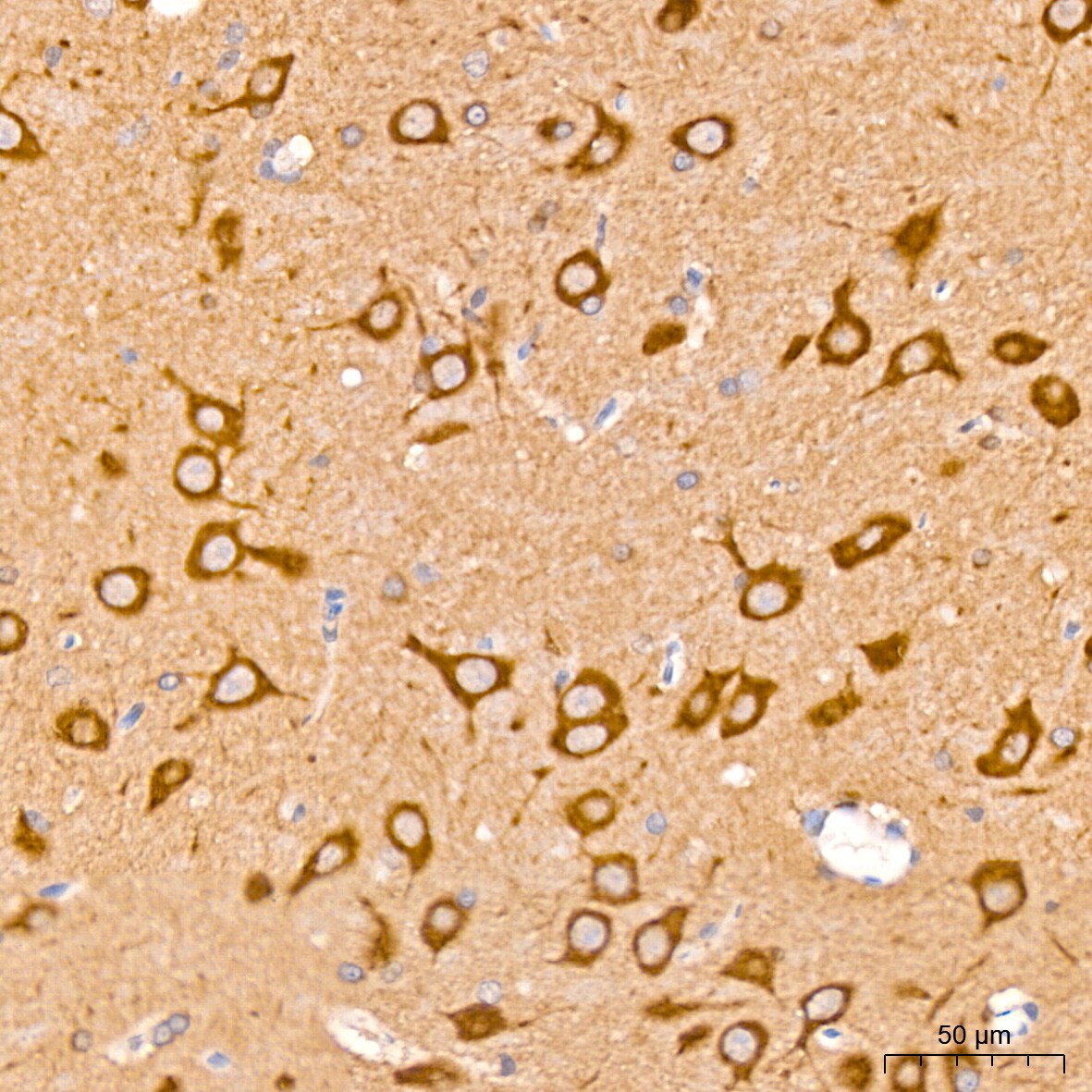 Huntingtin Antibody (7B9C8)