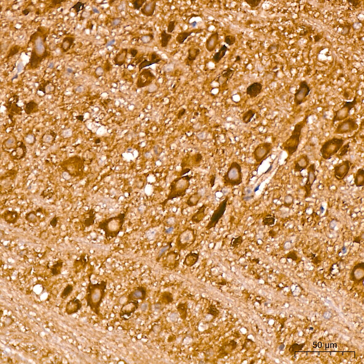 Huntingtin Antibody (7B9C8)