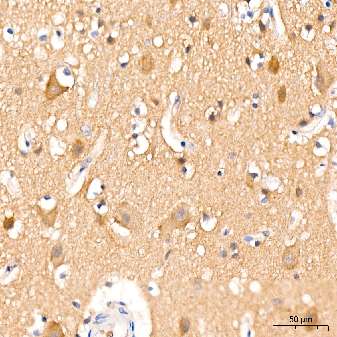 Huntingtin Antibody (7B9C8)