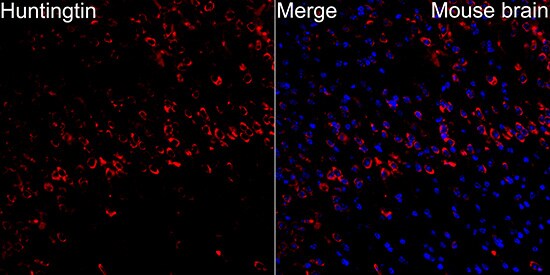Huntingtin Antibody (7B9C8)