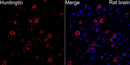 Huntingtin Antibody (7B9C8)