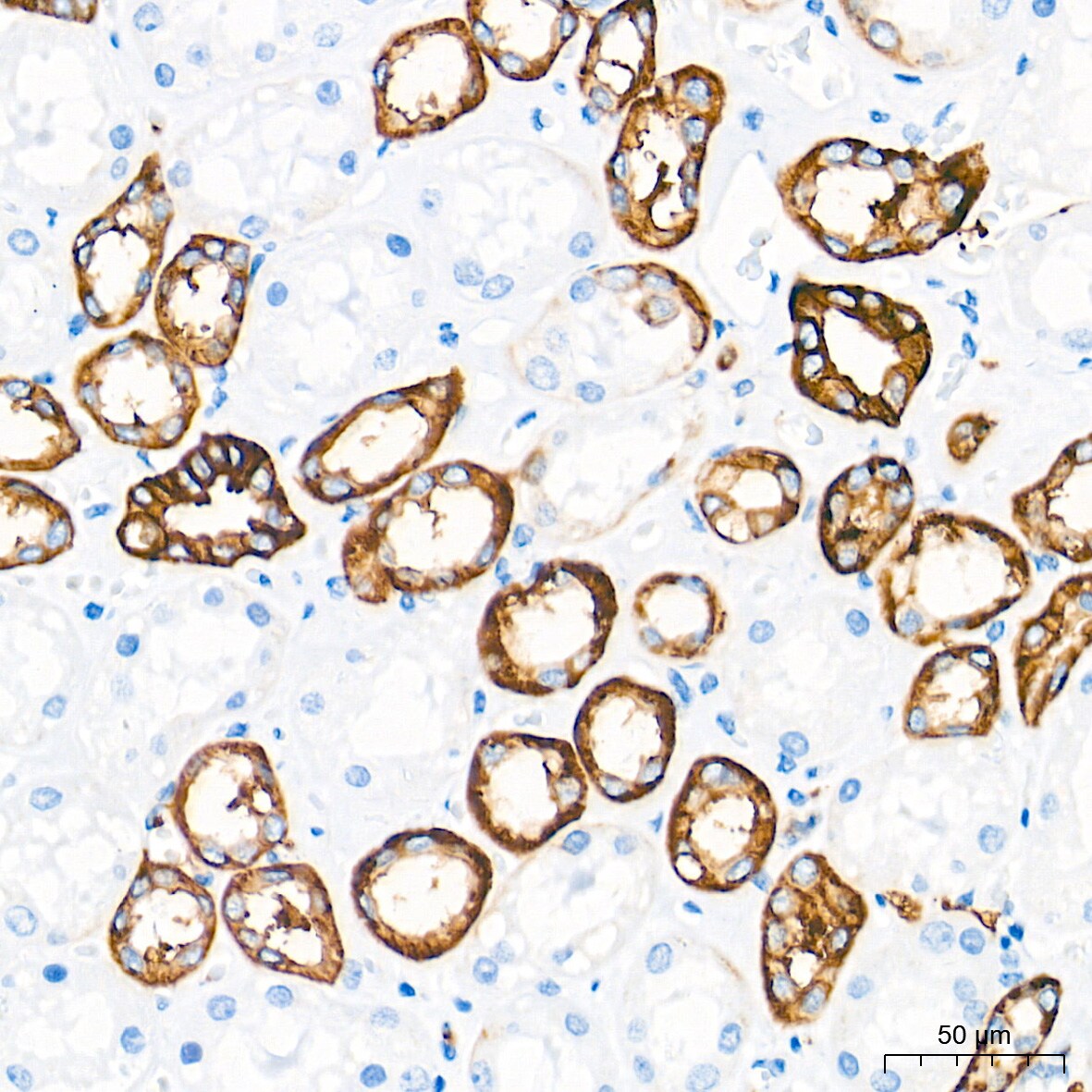Integrin alpha 2/CD49b Antibody (7O9H6)