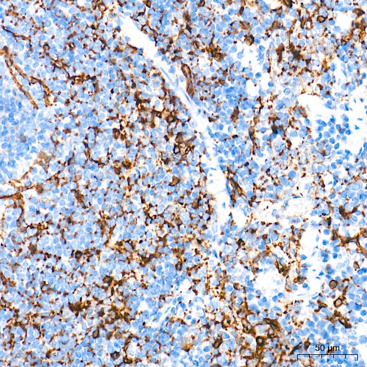 Integrin alpha 2/CD49b Antibody (7O9H6)