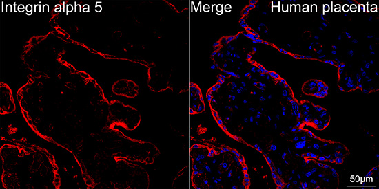 Integrin alpha 5/CD49e Antibody (8F2O6)