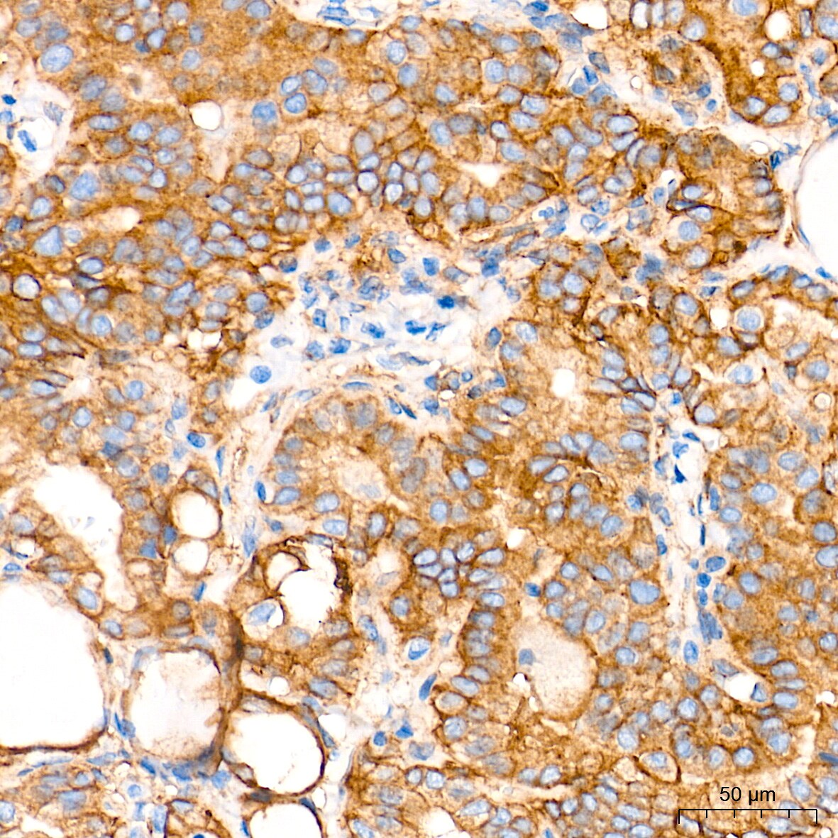 Integrin alpha V/CD51 Antibody (10T9N2)