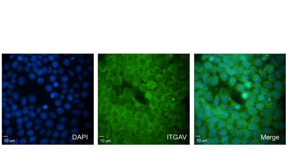 Integrin alpha V/CD51 Antibody (7O8N2)