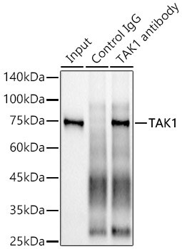 TAK1 Antibody (1W2B10)